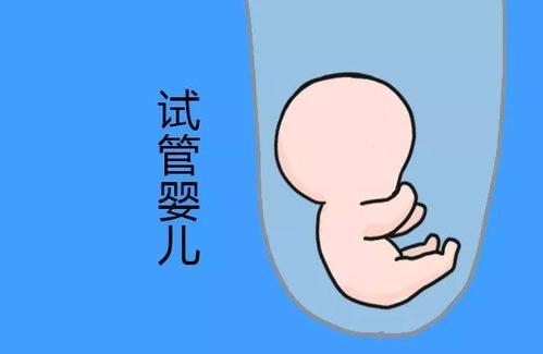 染色体易位